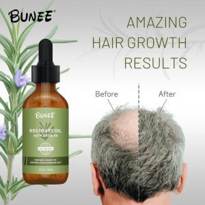 Bunee Rosemary Hair Growth Serum Oil 30ml (Pack Of 2/3)